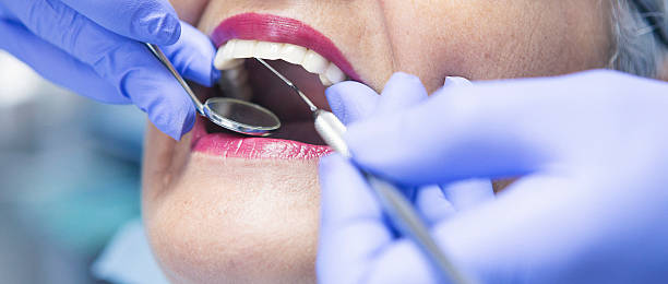 Best Dentist for Tooth Abscess  in Fort Davis, TX